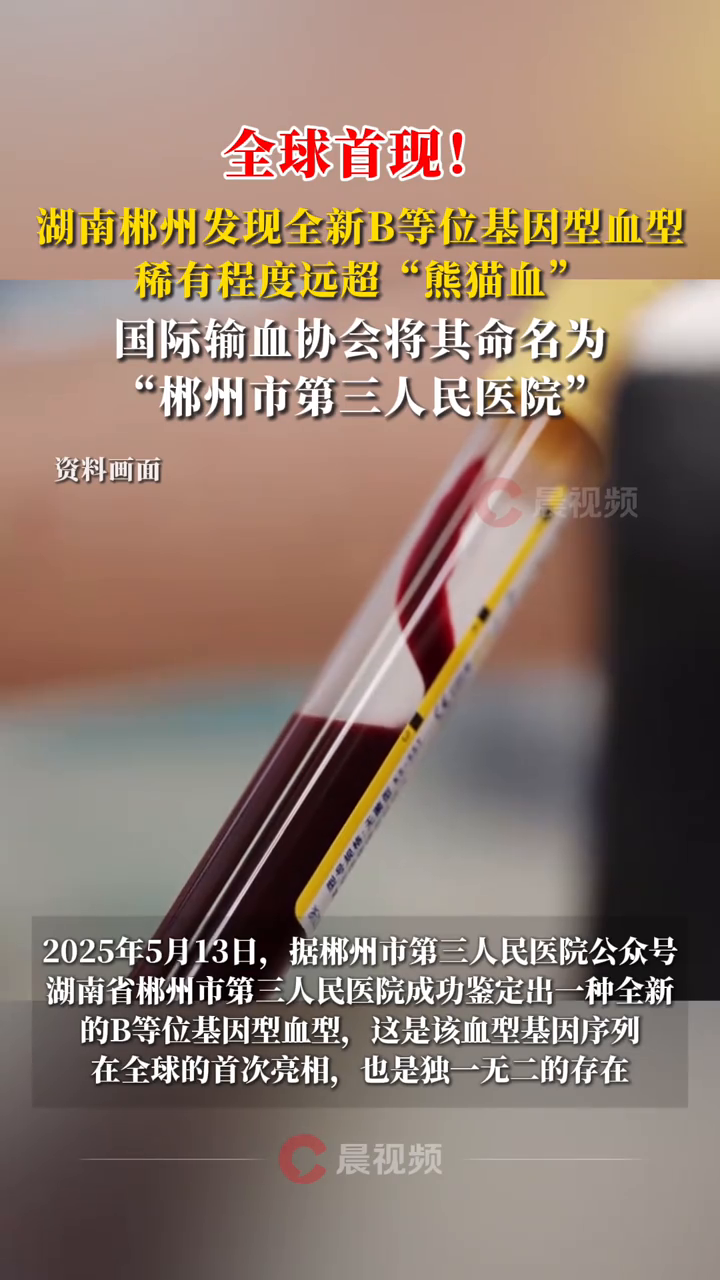  湖南郴州發(fā)現(xiàn)比熊貓血還稀有的血型