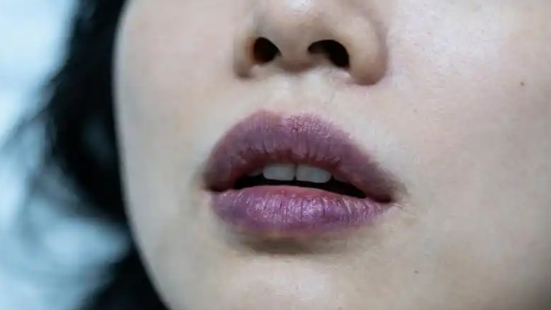 嘴唇发紫能“自测”心脑血管疾病吗
