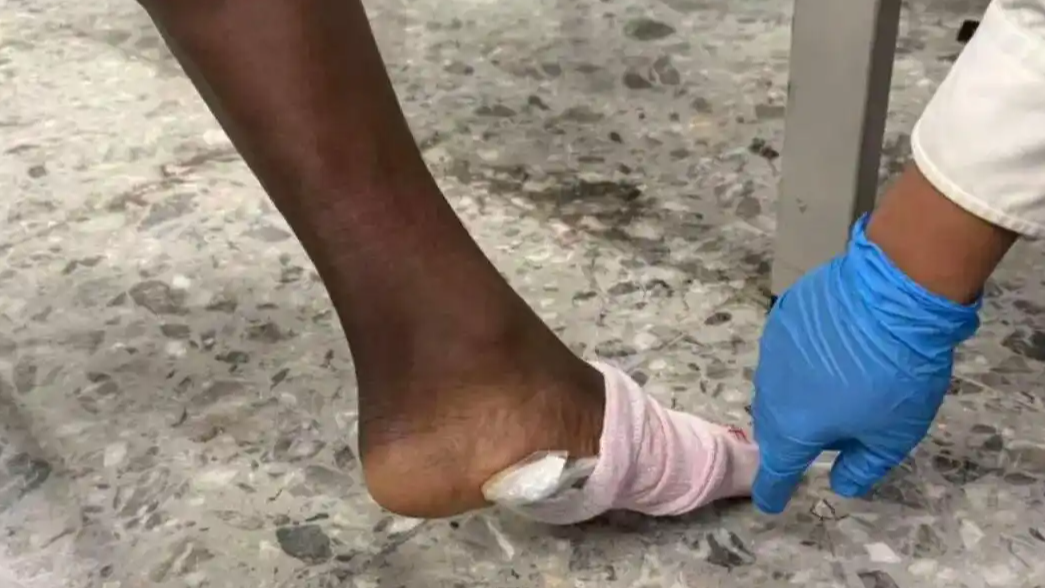 脚底藏大麻被海关闻出