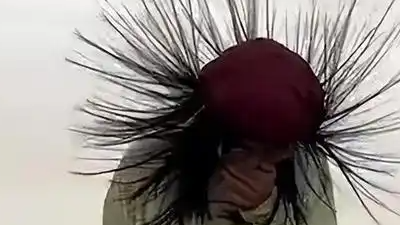 在户外头发突然竖起怎么办