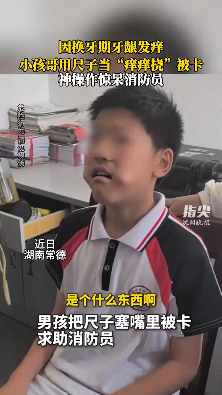  小孩哥牙龈发痒用尺子当痒痒挠被卡
