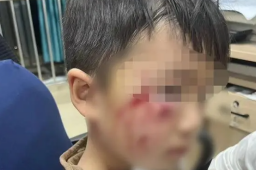 3岁男童被恶犬咬伤离世 母亲发声