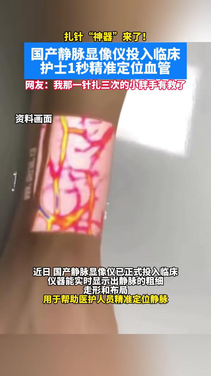  打针神器国产静脉显像仪投入临床