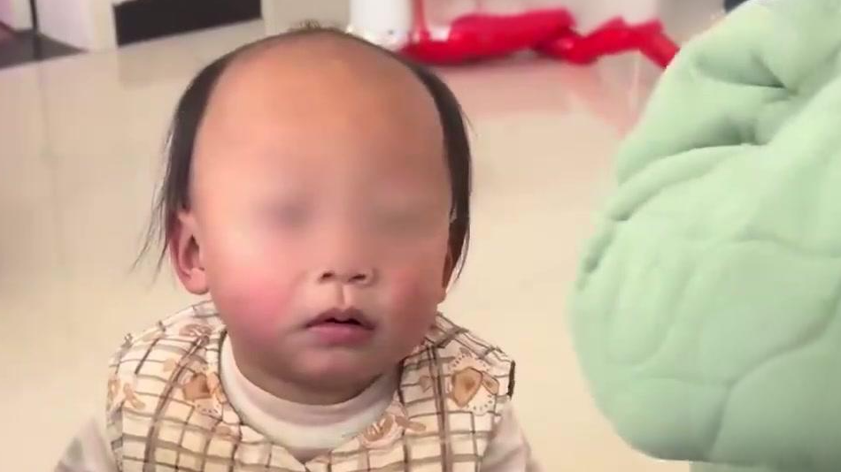 1岁萌娃“前额秃”被嘲像50岁？别慌！医生一句话让所有家长安心