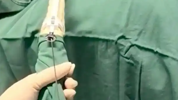 患癌妻子申请销毁婚外胚胎遭拒