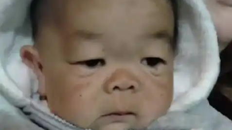  25岁小伙身高仅60多厘米