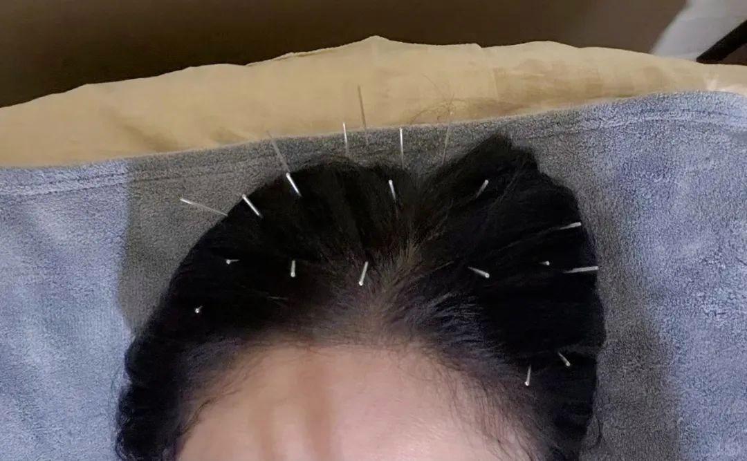 46歲陳喬恩曬做針雕保養(yǎng)照