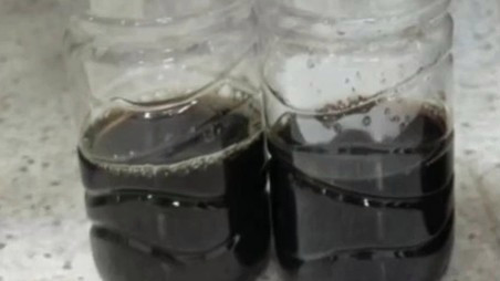 8岁男孩发烧10天尿出酱油色