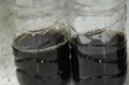   8岁男孩发烧10天尿出酱油色 缩略图