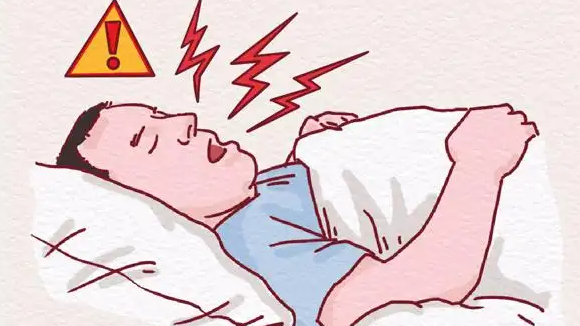 打鼾男子为不影响妻子睡眠动手术
