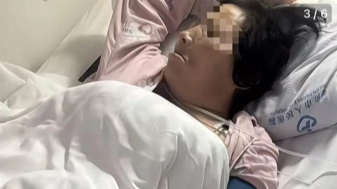 患者被一次性拔牙12颗后心梗休克