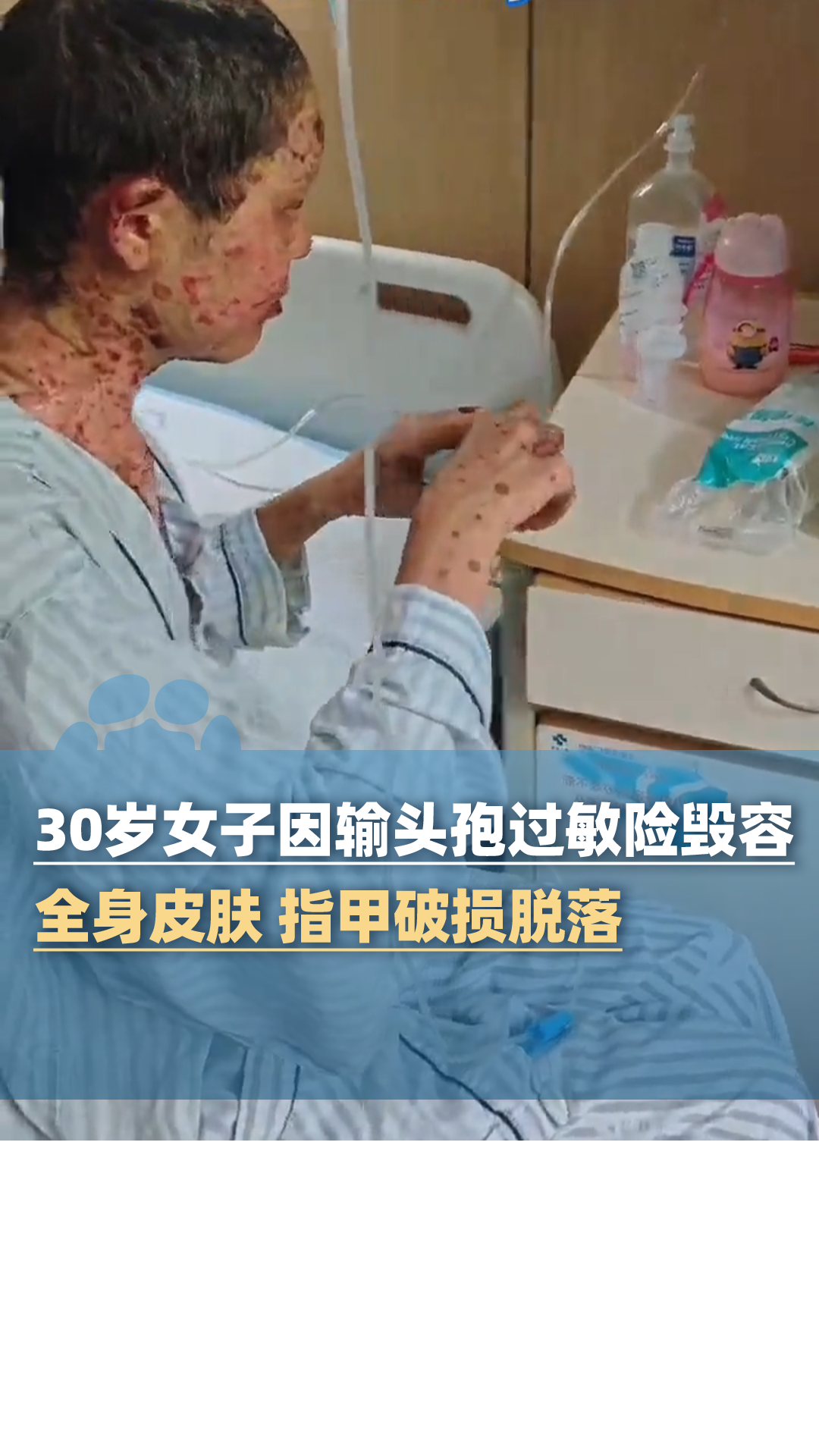 韩国农产品价格上涨 1个西瓜173元