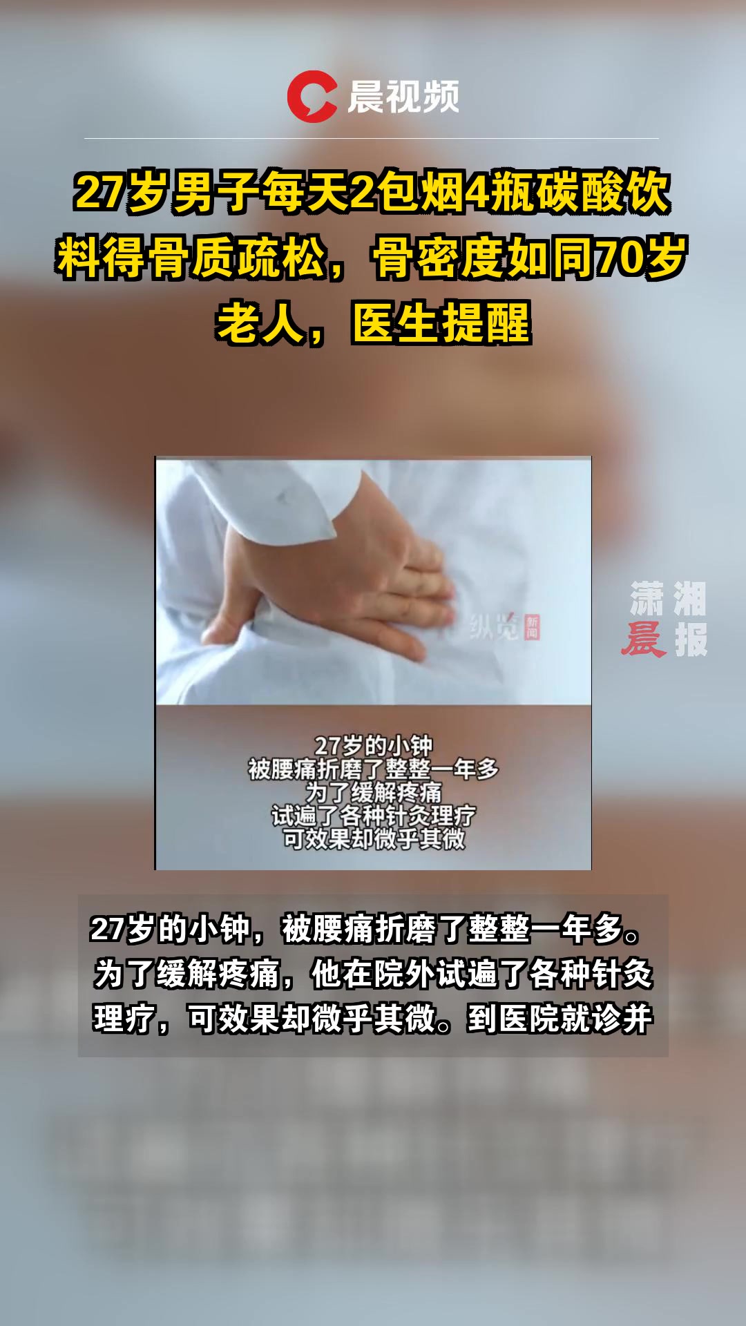  男子每天2包烟4瓶饮料得骨质疏松