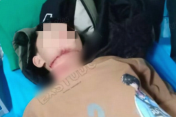   遭割喉男孩仍有一段气管未找到 缩略图