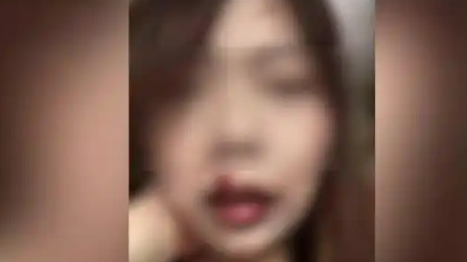 女子被养2年猫攻击致颅部3级损伤