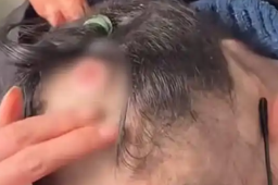   父亲1天干20个小时筹钱救患癌女儿 缩略图