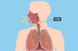   男子咳嗽一年多 竟是瓜子皮惹的祸 缩略图