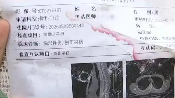  小伙花598元踩背几天后查出骨折