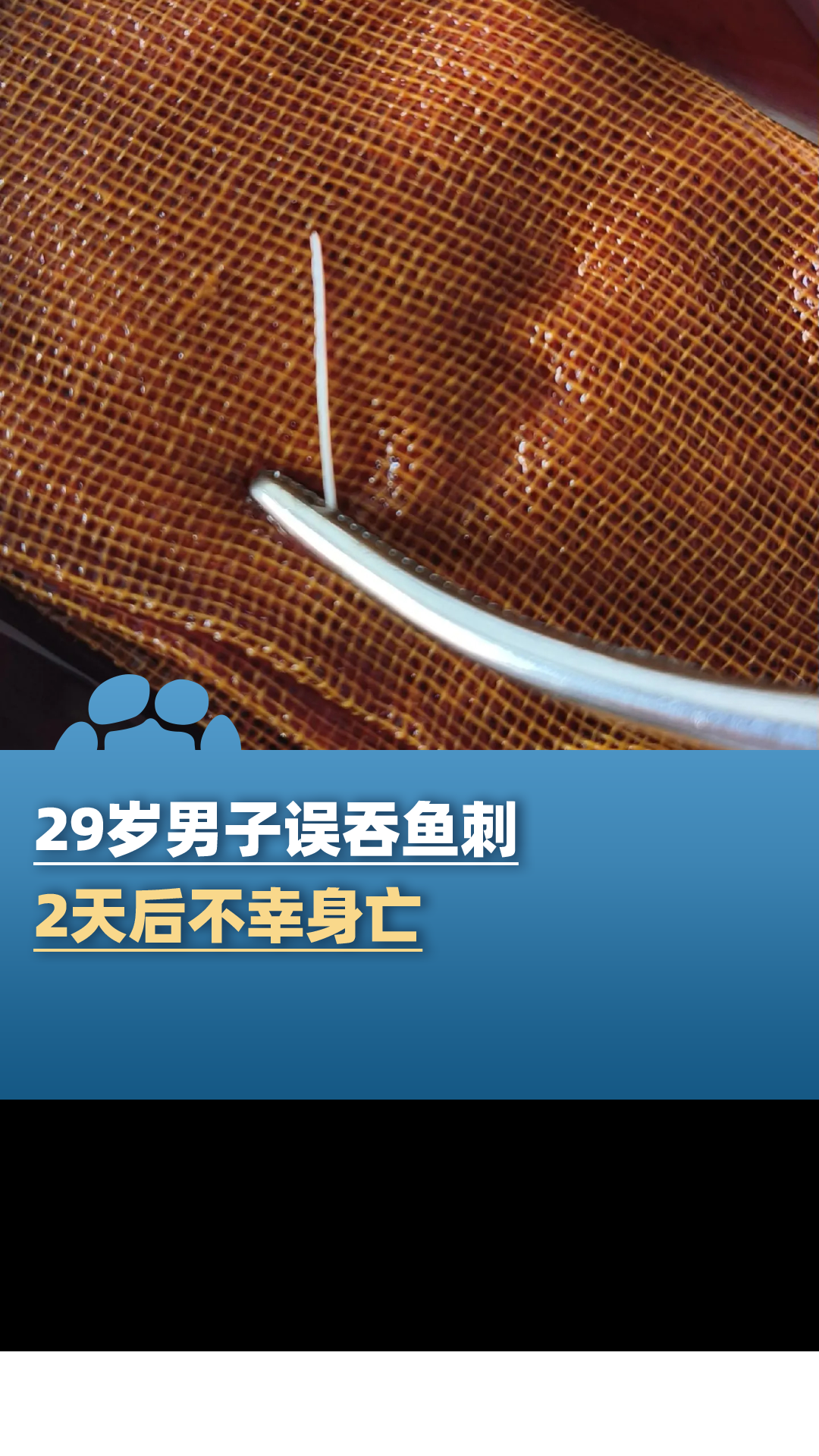  29岁男子误吞鱼刺两天后不幸身亡