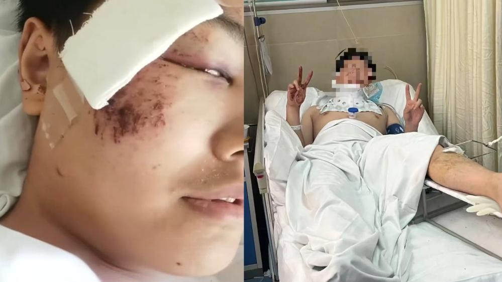 男子梦中被追跳下3楼 醒来在空中