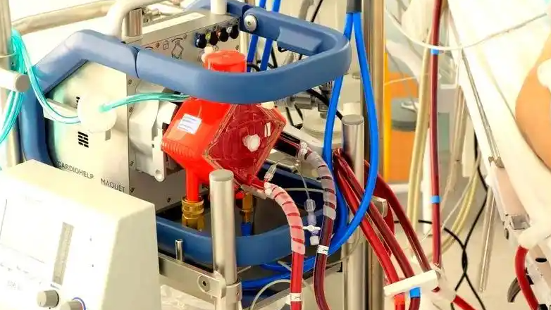 人工肺助患者器官移植前生存48小时