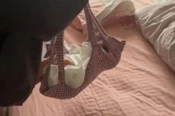   出生4天被秤砣砸中女婴3次尿血 缩略图