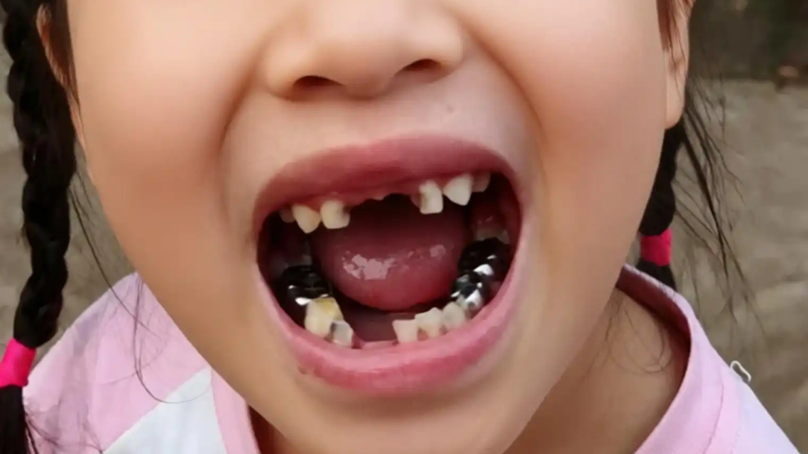 宇树机器人踢掉女孩牙齿 涉事方回应