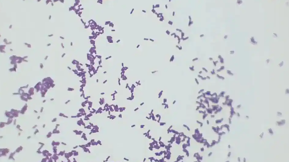 这个隐匿的“冰箱杀手”别忽视