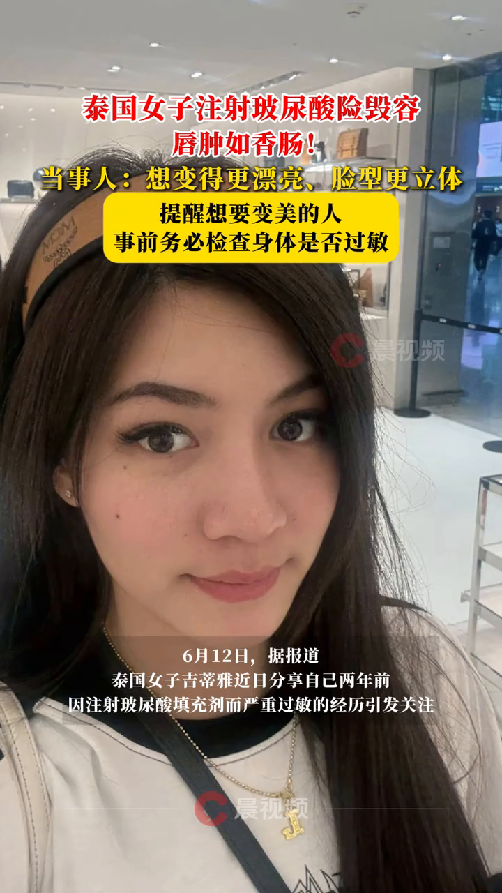  泰女子注射玻尿酸险毁容唇肿如香肠