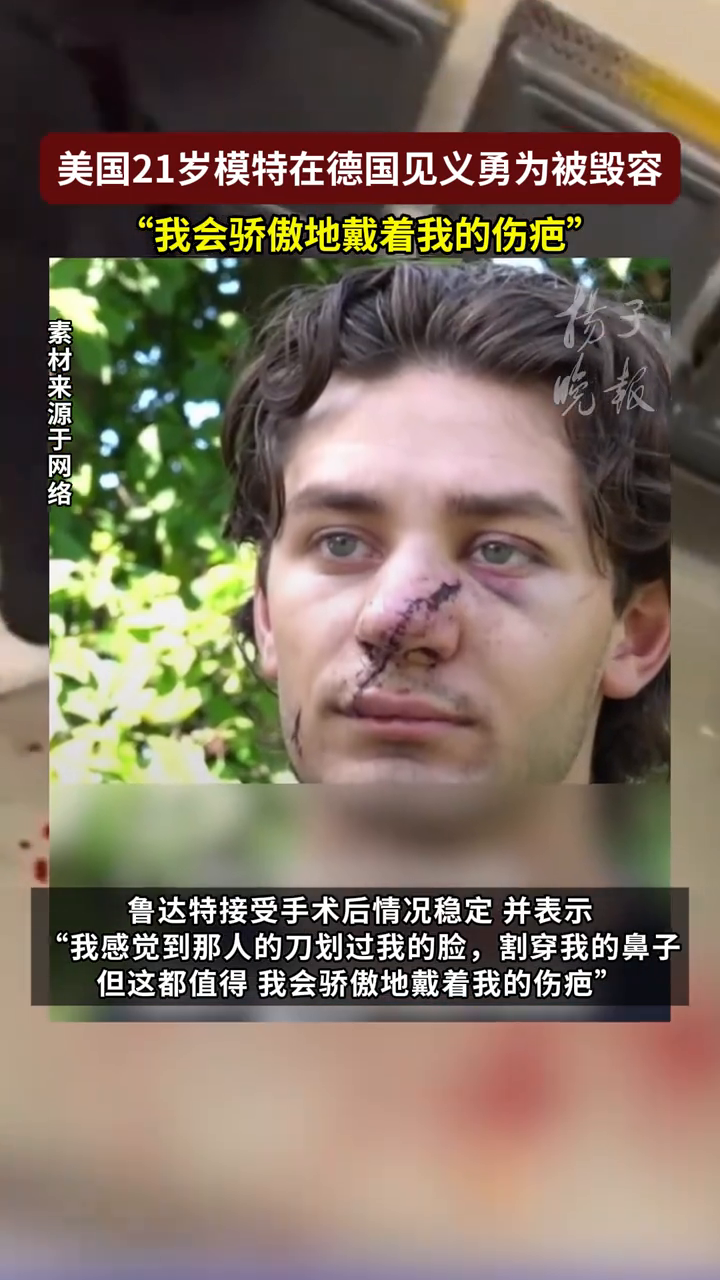 国家疾控局局长带队赶赴广东佛山