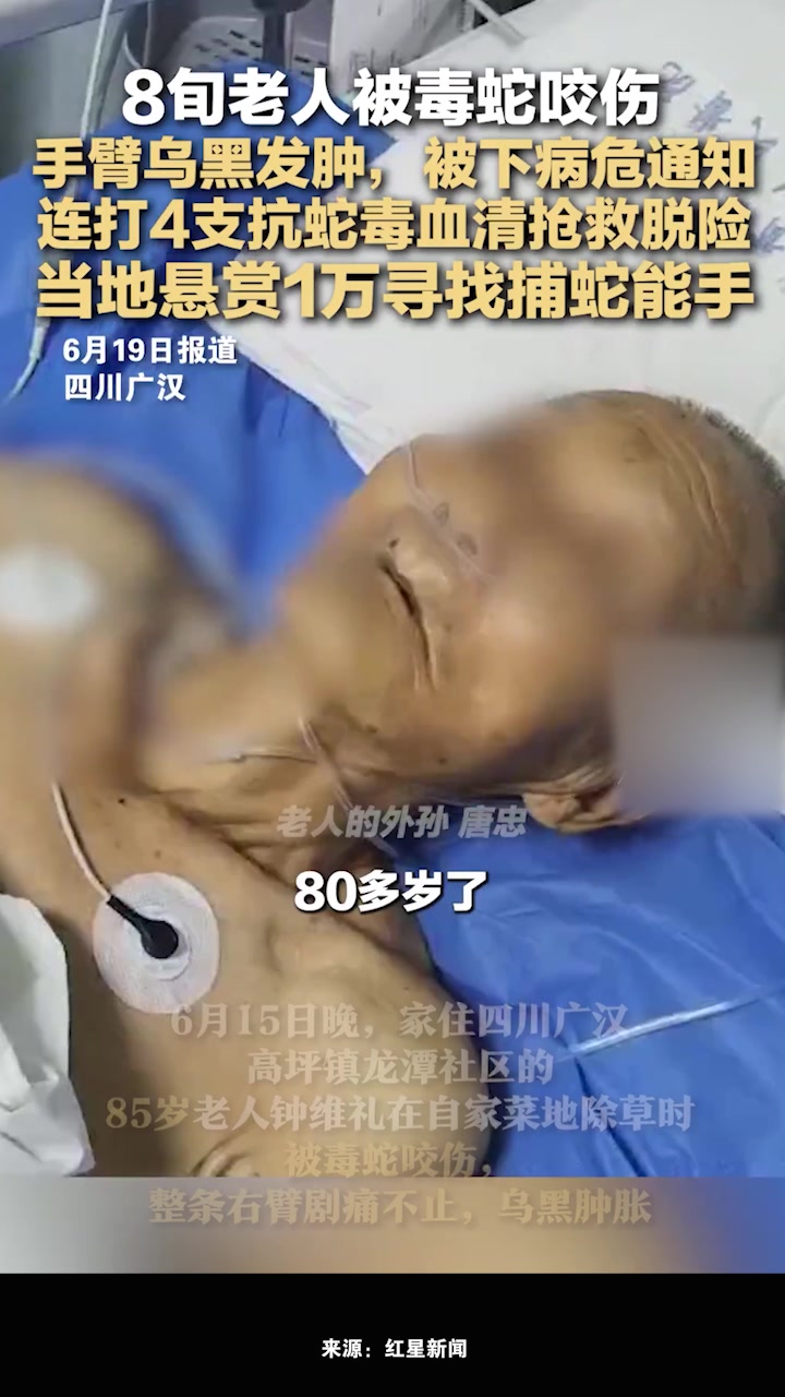 老人被毒蛇咬连打4支血清抢救脱险