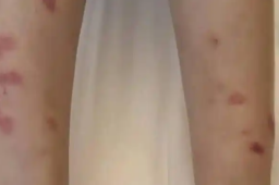 25日