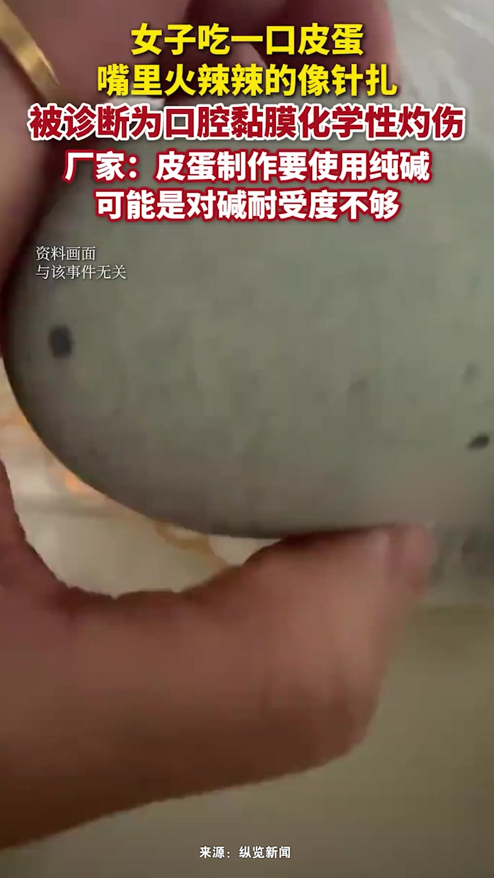  女子吃皮蛋口腔黏膜竟被灼伤